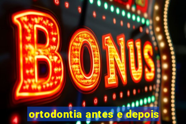 ortodontia antes e depois