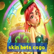 skin bets csgo